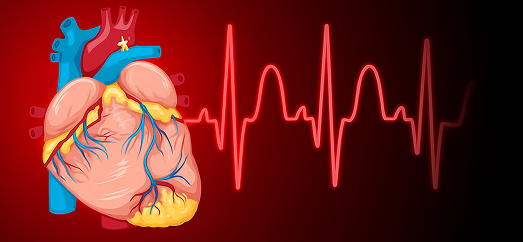 اضطرابات نظم القلب 2 cardiac arrhythmia, arrhythmia treatment