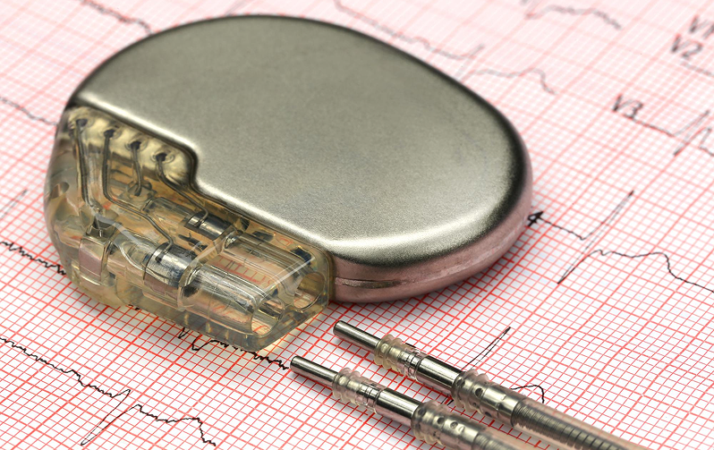 ICD implant surgery in Dubai - اجهزة تنظيم عمل القلب