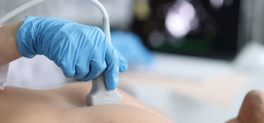 صدى القلب (ايكو) 2 2d echo test in Dubai