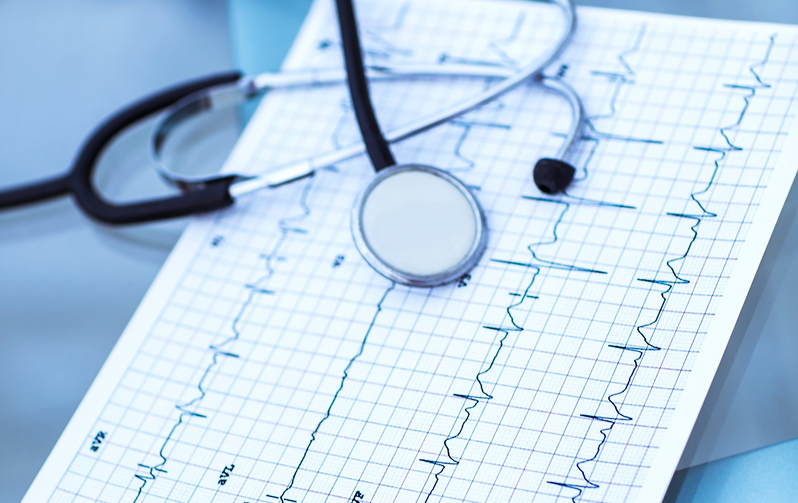 كهربائية القلب ECG 1 ECG test Dubai, ECG Test in Dubai - تخطيط كهربية القلب