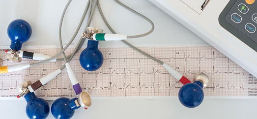 كهربائية القلب ECG 2 ECG test cost in Dubai, ecg test price, electrocardiogram test