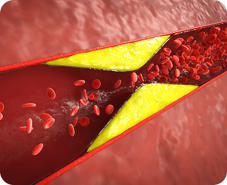 Cradiologist Packages