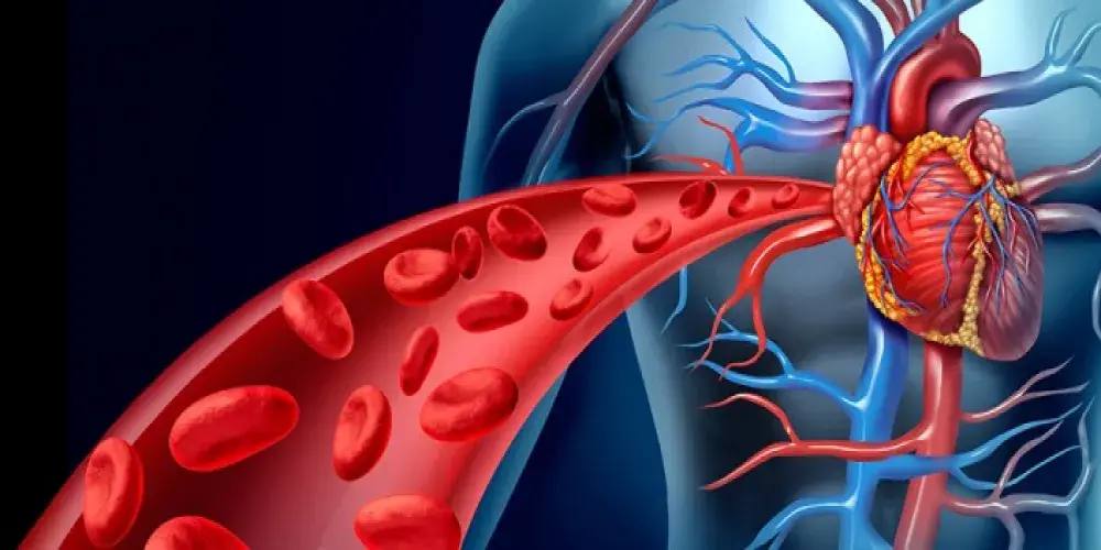 الانسداد الحاد في الشريان التاجي