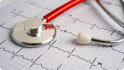 ECG test in dubai