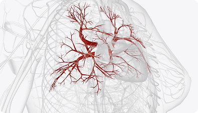Coronary Angiography in dubai