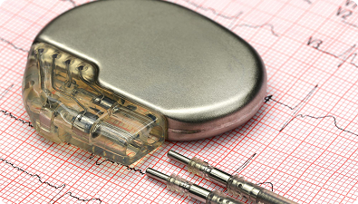 Pacemaker & ICD Implant in dubai متى يكون خفقان القلب خطير