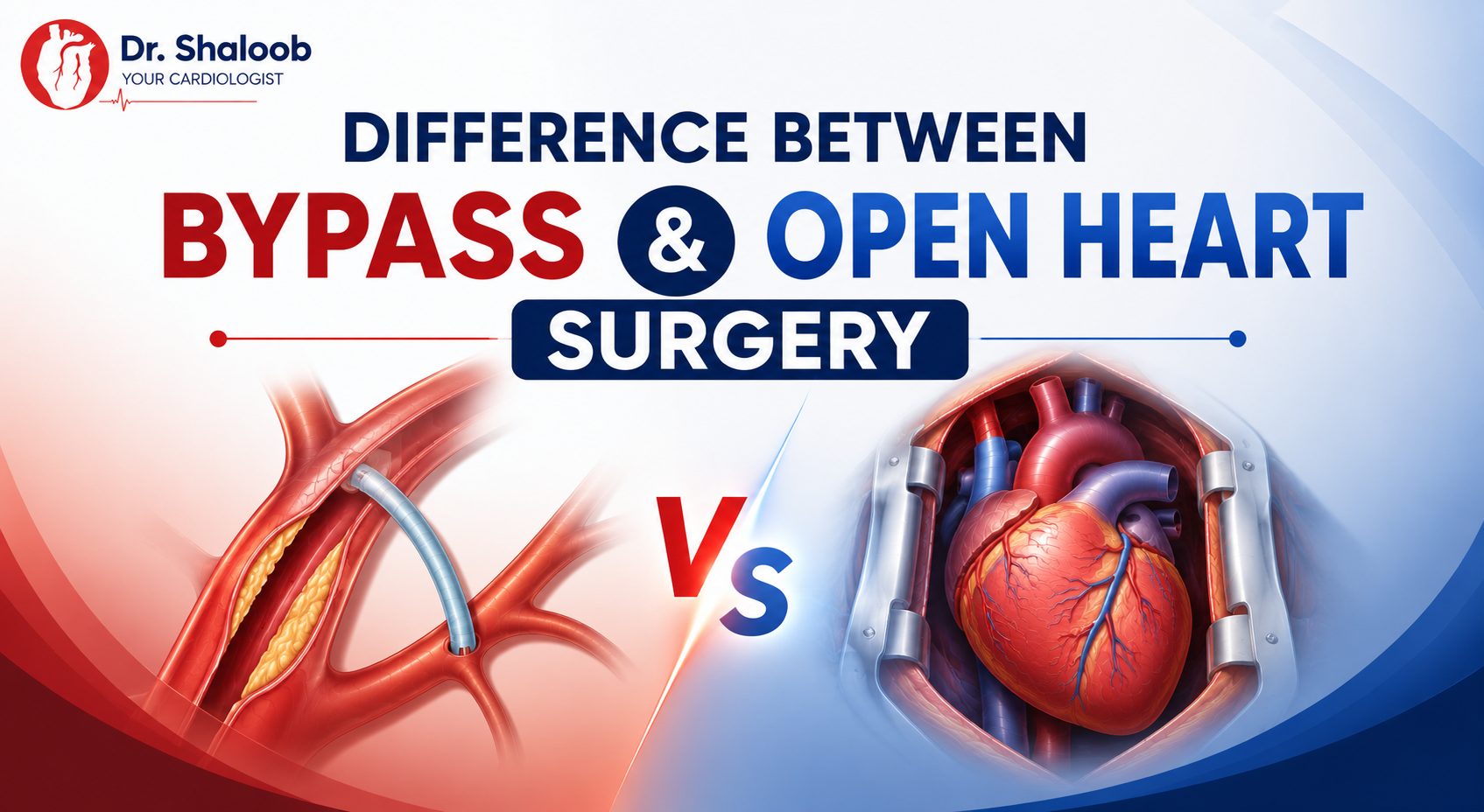 Home 53 difference between bypass and open heart surgery